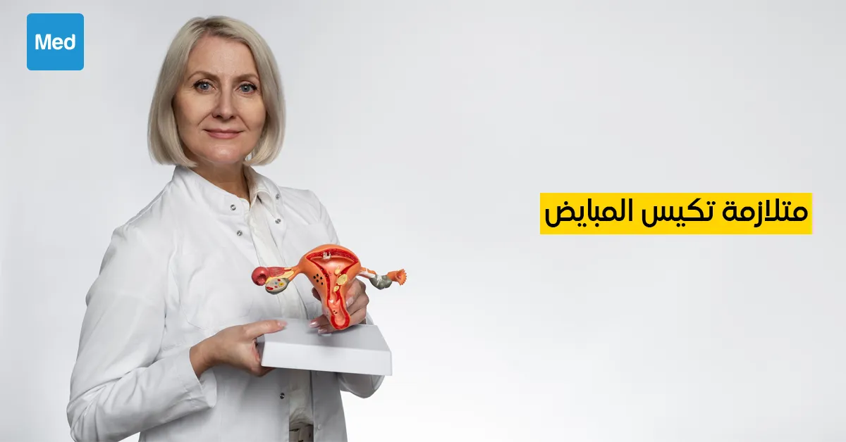 متلازمة تكيس المبايض : الأعراض والأسباب والعلاج